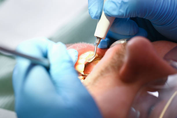 Best Emergency Treatment for Toothache in Sophia, WV